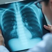 Jak długo zaraża chory na zapalenie płuc? Odpowiedzi i fakty