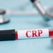 Jak wysokie CRP powinno niepokoić? Wartości i interpretacja
