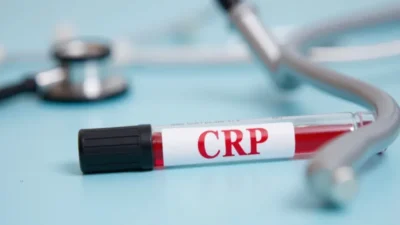 Jak wysokie CRP powinno niepokoić? Wartości i interpretacja
