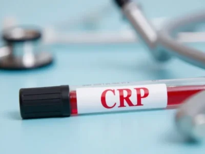Jak wysokie CRP powinno niepokoić? Wartości i interpretacja